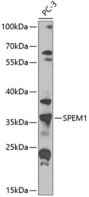 Western Blot: SPEM1 AntibodyBSA Free [NBP3-04838]