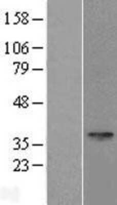 Western Blot: SPEM1 Overexpression Lysate [NBL1-16392]