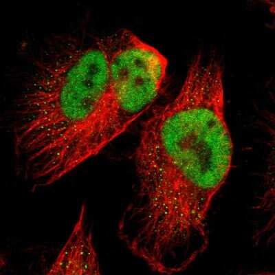 Immunocytochemistry/ Immunofluorescence: SPEN Antibody [NBP1-82952]