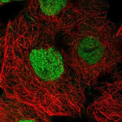 Immunocytochemistry/ Immunofluorescence: SPEN Antibody [NBP2-55635]