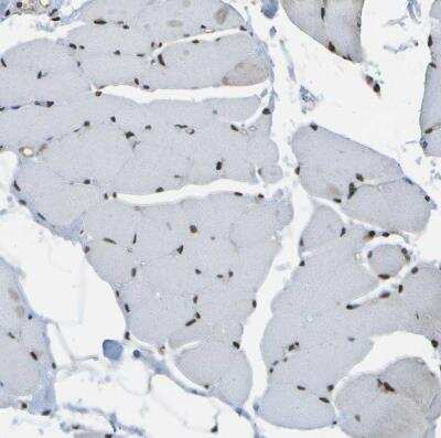 Immunohistochemistry-Paraffin: SPEN Antibody [NBP1-82952]