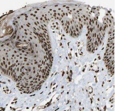 Immunohistochemistry-Paraffin: SPEN Antibody [NBP1-82952]