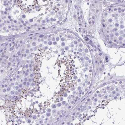Immunohistochemistry-Paraffin: SPERT Antibody [NBP1-86592]