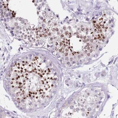 Immunohistochemistry-Paraffin: SPESP1 Antibody [NBP2-13370]
