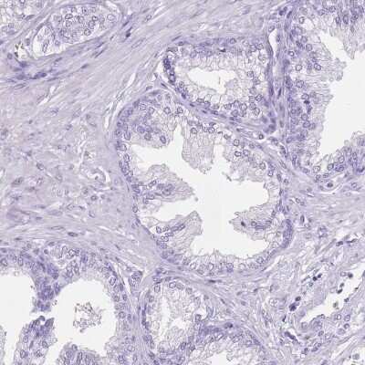 Immunohistochemistry-Paraffin: SPESP1 Antibody [NBP2-13370]