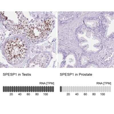 Immunohistochemistry-Paraffin: SPESP1 Antibody [NBP2-13370]