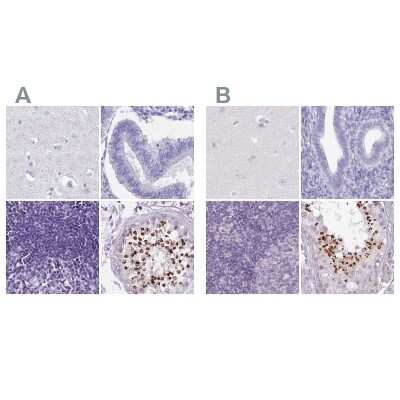 Immunohistochemistry-Paraffin: SPESP1 Antibody [NBP2-13370]