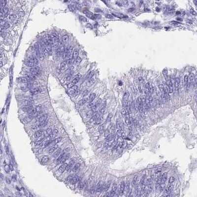 Immunohistochemistry-Paraffin: SPESP1 Antibody [NBP2-13370]