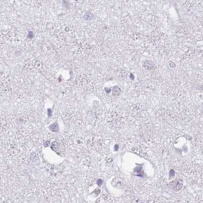 Immunohistochemistry-Paraffin: SPESP1 Antibody [NBP2-13370]