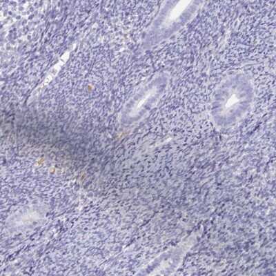 Immunohistochemistry-Paraffin: SPESP1 Antibody [NBP2-48994]