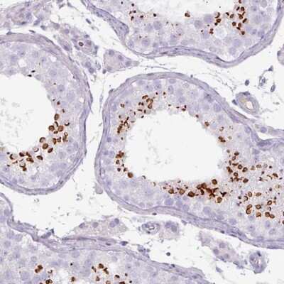 Immunohistochemistry-Paraffin: SPESP1 Antibody [NBP2-48994]