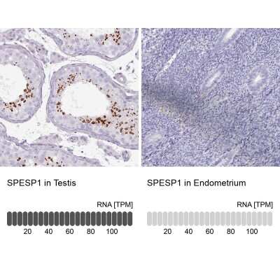 Immunohistochemistry-Paraffin: SPESP1 Antibody [NBP2-48994]