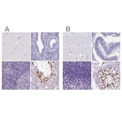 Immunohistochemistry-Paraffin: SPESP1 Antibody [NBP2-48994]