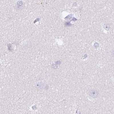 Immunohistochemistry-Paraffin: SPESP1 Antibody [NBP2-48994]