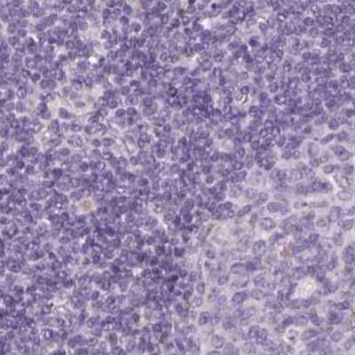 Immunohistochemistry-Paraffin: SPESP1 Antibody [NBP2-48994]