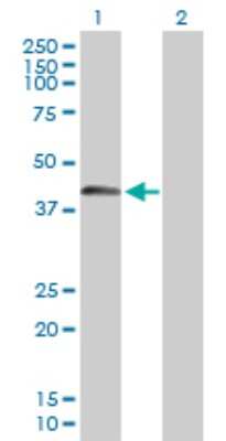 Western Blot: SPESP1 Antibody [H00246777-B01P]