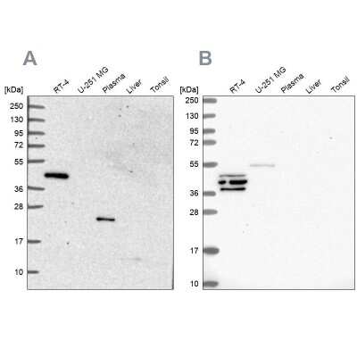 Western Blot: SPESP1 Antibody [NBP2-13370]