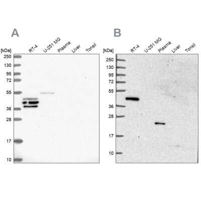 Western Blot: SPESP1 Antibody [NBP2-48994]