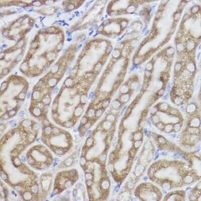Immunohistochemistry-Paraffin: SPFH2 Antibody (9T3M5) [NBP3-15305]