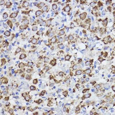 Immunohistochemistry-Paraffin: SPFH2 Antibody (9T3M5) [NBP3-15305]