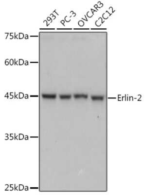 Western Blot: SPFH2 Antibody (9T3M5) [NBP3-15305]