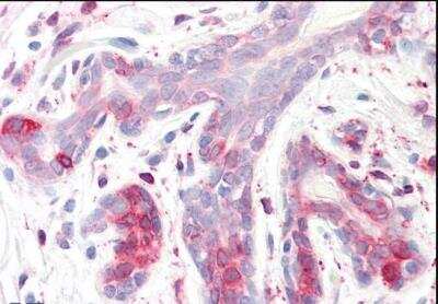 Immunohistochemistry-Paraffin: SPFH2 Antibody [NB100-1884]
