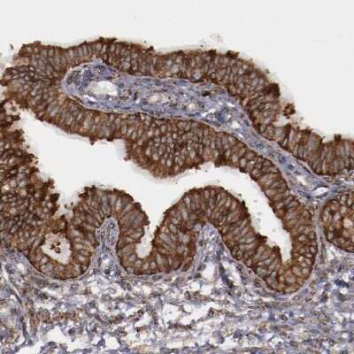 Immunohistochemistry-Paraffin: SPFH2 Antibody [NBP1-88247]