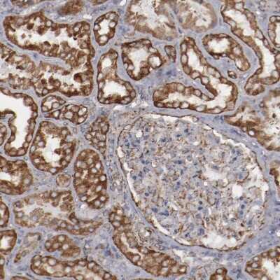 Immunohistochemistry-Paraffin: SPFH2 Antibody [NBP1-88247]
