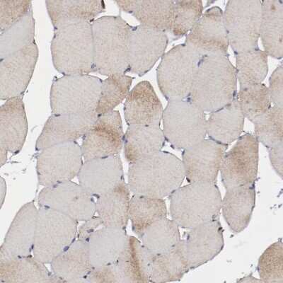 Immunohistochemistry-Paraffin: SPFH2 Antibody [NBP1-88247]