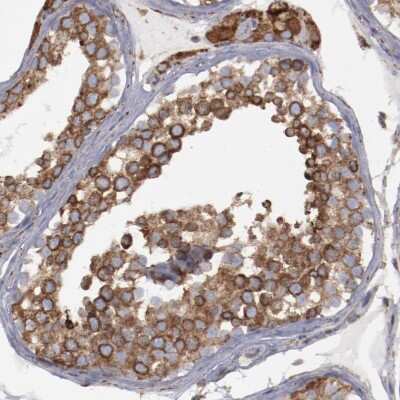 Immunohistochemistry-Paraffin: SPFH2 Antibody [NBP1-88247]