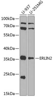 Western Blot: SPFH2 AntibodyBSA Free [NBP2-95242]