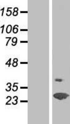 Western Blot: SPFH2 Overexpression Lysate [NBP2-10380]