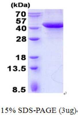 SDS-PAGE: Recombinant Human SPFH2 His Protein [NBP2-23027]