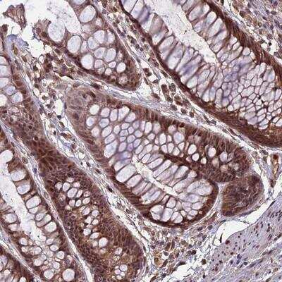 Immunohistochemistry-Paraffin: SPG11 Antibody [NBP1-82142]