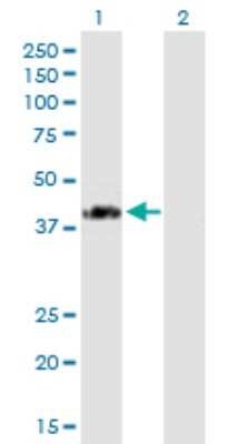 Western Blot: SPG11 Antibody [H00080208-B01P]