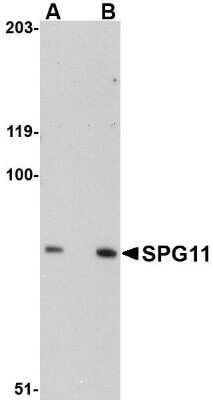 Western Blot: SPG11 AntibodyBSA Free [NBP1-76990]