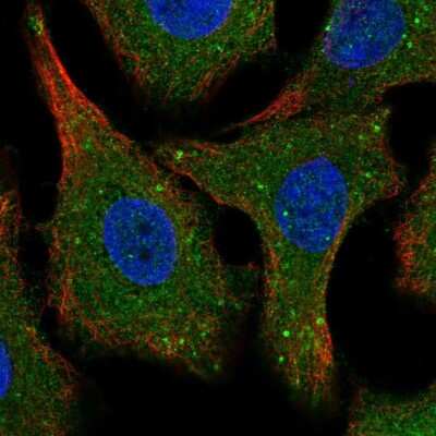 Immunocytochemistry/ Immunofluorescence: SPG21 Antibody [NBP2-56164]