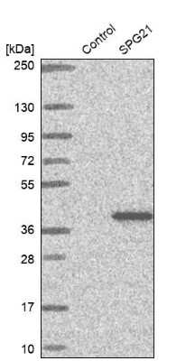 Western Blot: SPG21 Antibody [NBP1-89273]