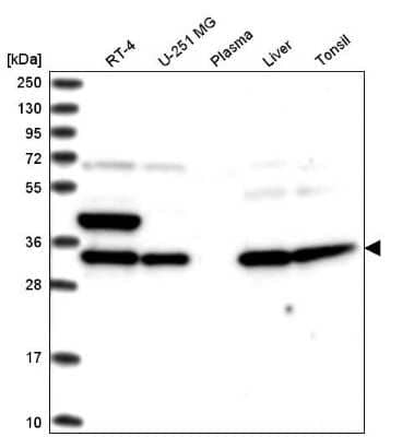 Western Blot: SPG21 Antibody [NBP2-56164]