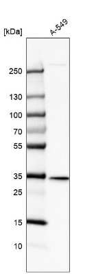 Western Blot: SPG21 Antibody [NBP2-56164]