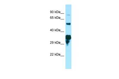 Western Blot: SPG21 Antibody [NBP3-09475]