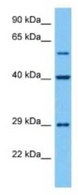 Western Blot: SPG21 Antibody [NBP3-10044]