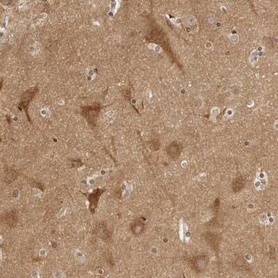 Immunohistochemistry-Paraffin: SPG3A Antibody [NBP1-90234]