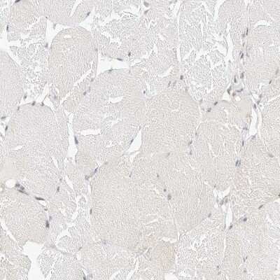 Immunohistochemistry-Paraffin: SPG3A Antibody [NBP1-90234]