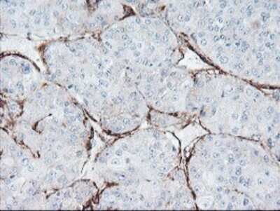 Immunohistochemistry: SPG7 Antibody (OTI1G4) [NBP2-45943]