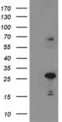 Western Blot: SPG7 Antibody (OTI1G4) [NBP2-45943]