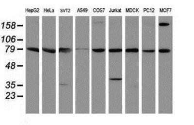 Western Blot: SPG7 Antibody (OTI1C1)Azide and BSA Free [NBP2-74327]