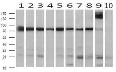 Western Blot: SPG7 Antibody (OTI1C1)Azide and BSA Free [NBP2-74327]