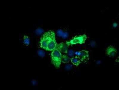 Immunocytochemistry/ Immunofluorescence: SPG7 Antibody (OTI1C1) [NBP2-01860]