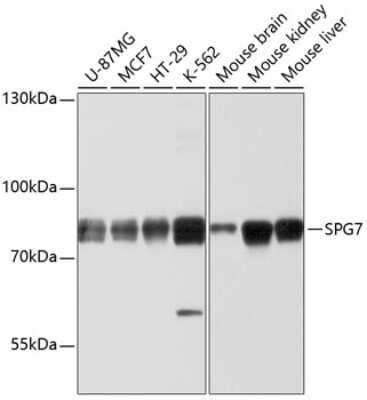 Western Blot: SPG7 AntibodyBSA Free [NBP2-93364]